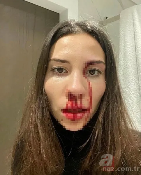 Özer Hurmacı ve Mihriban Hurmacı'nın darp davasında flaş gelişme 2