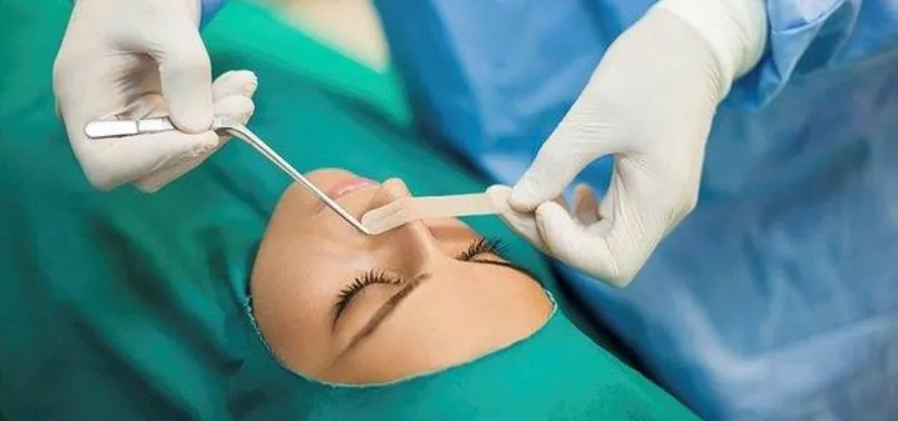 Yargıtay'dan emsal karar! Estetik yaptıracaklar dikkat