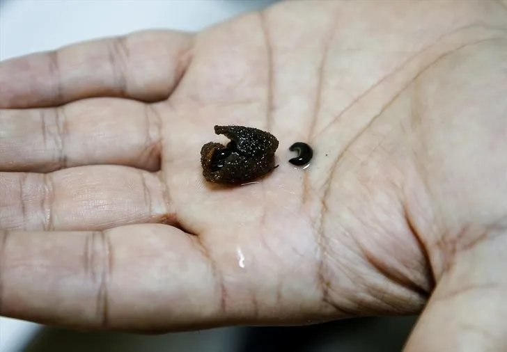 Sülüklerin nesli tükenme tehlikesiyle karşı karşıya! Uzmanlar uyardı…