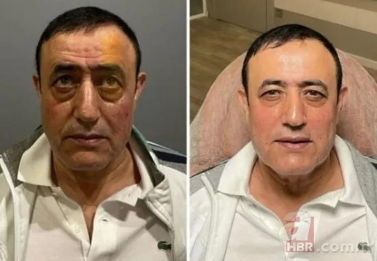 Türkücü Mahmut Tuncer'i bir de estetikli görün! Son hali sosyal medyayı salladı! "Aramıza hoş geldin..." 4