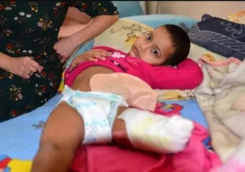 Adana Büyükşehir Belediyesi'nin kaderine terk ettiği küçük Rukiye'nin annesi feryat etti: Hiç değilse bunu yapın