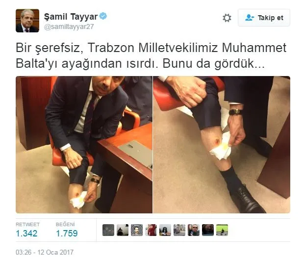 AK Parti milletvekili Muhammet Balta'nın bacağını kim ısırdı? - 1