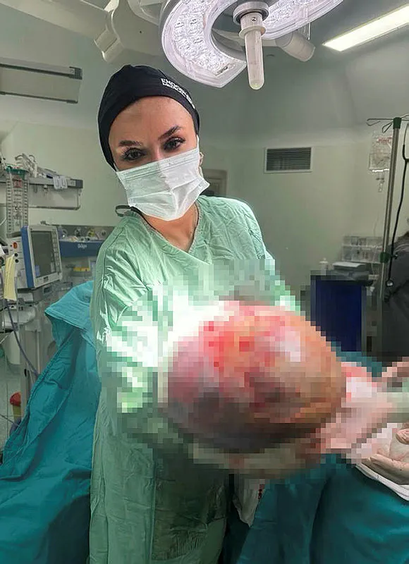 1700825101407.jpg Hastanın karnından çıkan kitle şoke etti! 50 santimetre 20 kilogram! Doktor böyle poz verdi... - 3