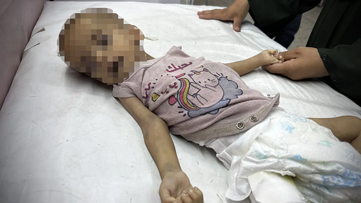 Dünya sessiz! Gazze'de Muhammed bebek açlıktan öldü