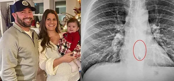 Son dakika: ’Bu kadarı ancak filmlerde olur’ dedirten olay! Uyurken bakın ne yutmuş?