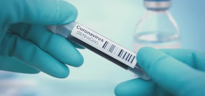 Oxford Üniversitesi’nden umutlandıran corona virüs aşısı denemesi!
