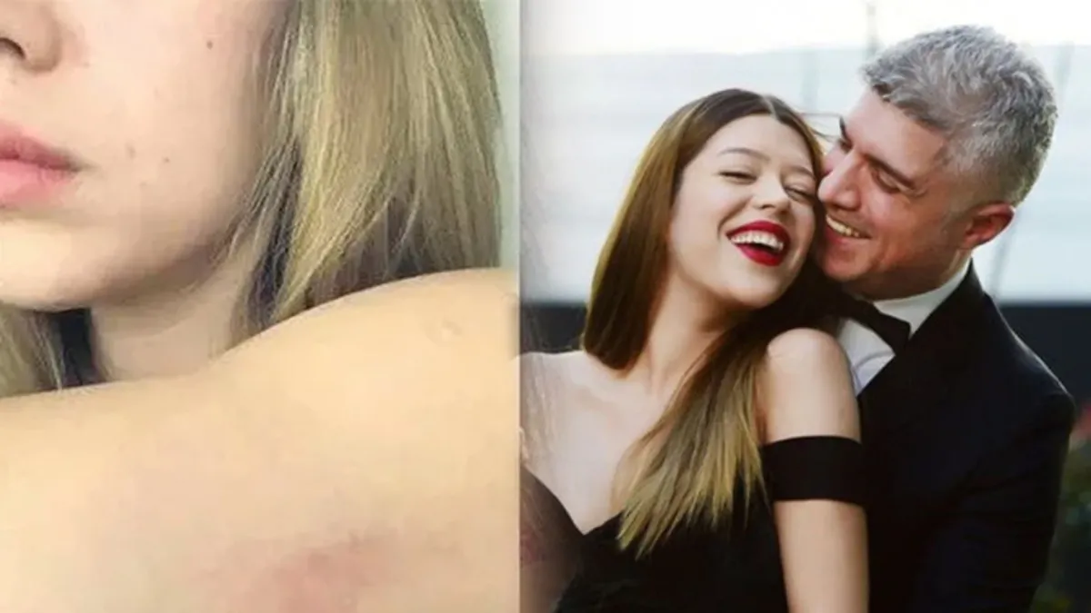 Özcan Deniz'den şiddet mi gördü? Feyza Aktan o fotoğraflara yanıt verdi