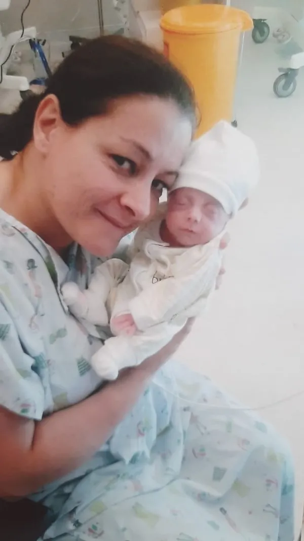 Kuvözden hayata ömürlük hayat bağı! Cesur yürekleri ve küçük parmaklarıyla yaşama tutunuyorlar - 6