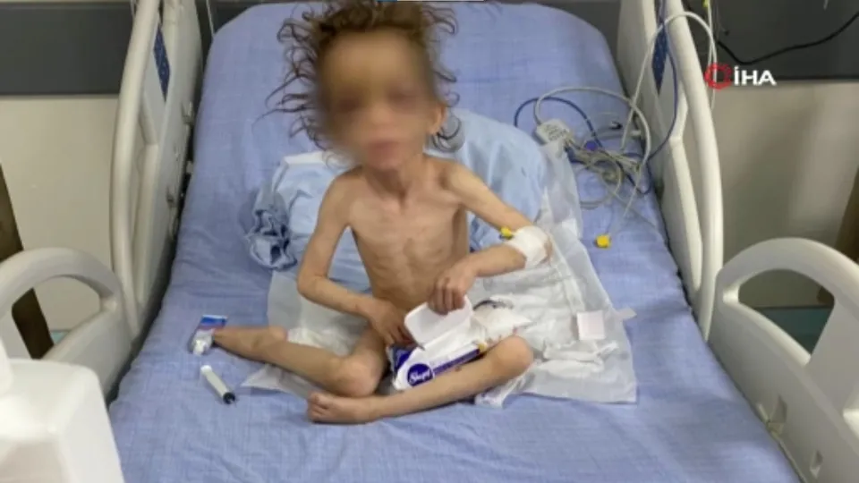 5 yaşındaki çocuk annesi tarafından günlerce işkenceye maruz kaldı! Gaziantep'ten Türkiye'yi sarsan skandal! Görüntüler kan dondurdu