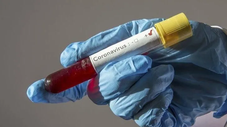 Coronavirüs salgınında Diyabet, obezite ve yüksek tansiyon hastalarına önemli uyarılar