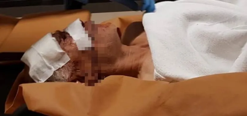 Ailesini katleden şahıs jandarma ile çatışmaya girdi