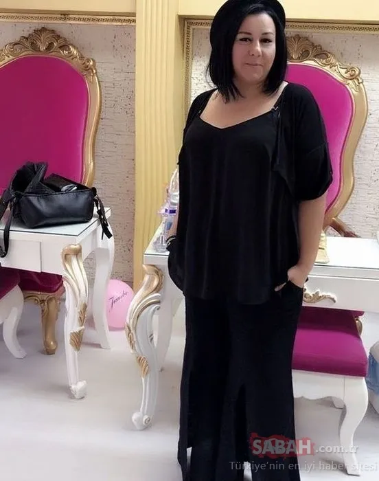 Adanalı dizisinin güzel oyuncusu Tuğçe Özbudak yeni haliyle olay oldu! Estetik yaptırmaktan öyle bir hale geldi ki... 25