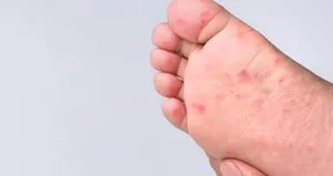 Uzmanı uyardı! Havuz suyundan bulaşıyor...