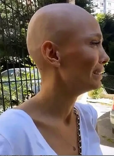 Kanser tedavisi gören şarkıcı Şimal hastaneye kaldırıldı