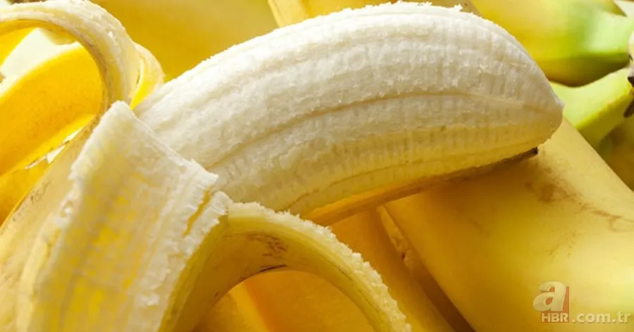 Diş beyazlatma yöntemleri işe yarıyor mu? 6