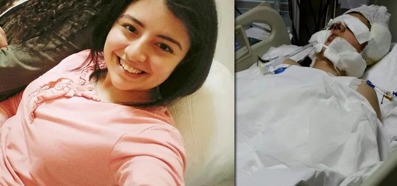 Burun Ameliyati Olan Kubra Oldu A Haber Son Dakika Saglik Haberleri