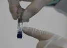 Müjde geldi! Yerli aşıda tarih belli oldu