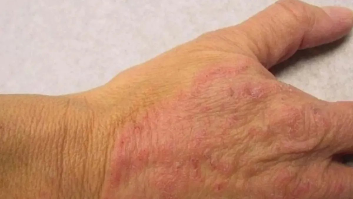 Rutubetli ortamlarda mantar tehlikesi!