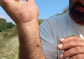 Uzmanlardan "kene" uyarısı: Vücutta kalma süresi riski artırıyor!