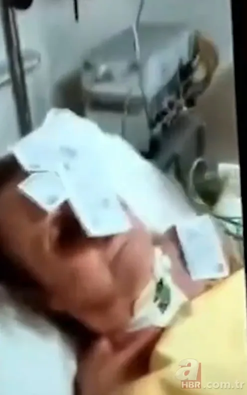 Özel hastanede skandal! Yoğun bakımdaki yaşlı kadına işkence yapıp kayda aldılar 2