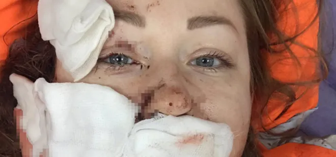 Boşanmak isteyen eşine falçatayla saldırmıştı! Cani koca tehditlerine devam ediyor