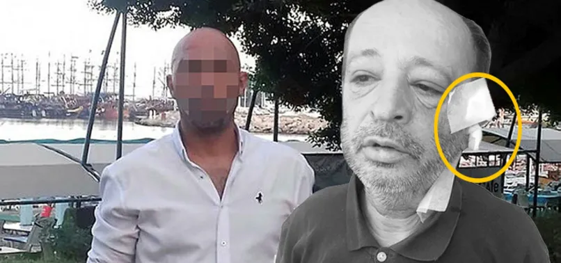 Arkadaşının kulağını maket bıçağıyla kesti! Sebebi ise tüyler ürpertti...