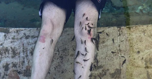 Başkan Erdoğan balıklı göl için imzayı attı! Sivas’ın doktor balıkları sağlık turizmi sağlayacak