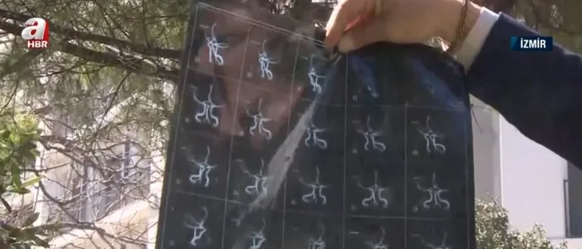 hastaligi-hayatini-kabusa-cevirdi-mucize-adam-ferkan-tas-hayata-hic-kusmedi-1713338404141.jpg Hastalığı hayatını kabusa çevirdi! Mucize adam Ferkan Taş hayata hiç küsmedi - 2