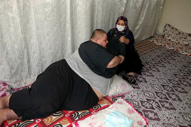 Gaziantep'te obezite hastası 280 kiloya ulaştı! Tek isteği sokakta yürümek ve çalışmak - 2