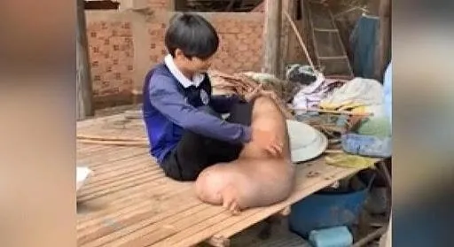 Sivrisinek ısırığı tedavisi olmayan hastalığa sebep oldu