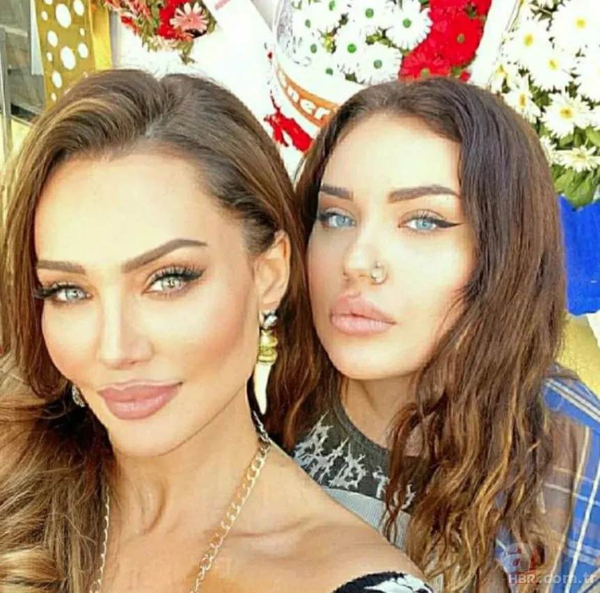 Böylesi görülmedi! Umut Akyürek bakın neresine estetik yaptırdı 14