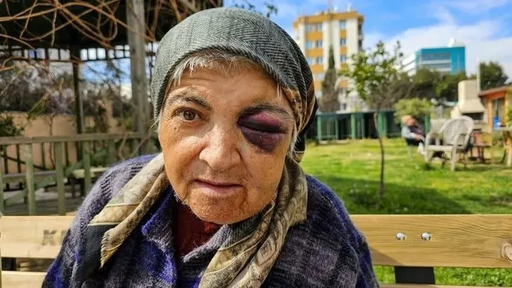 Antalya’da diyaliz merkezinde dehşet! Engelli kadın saldırıya uğradı | Gözleri morardı