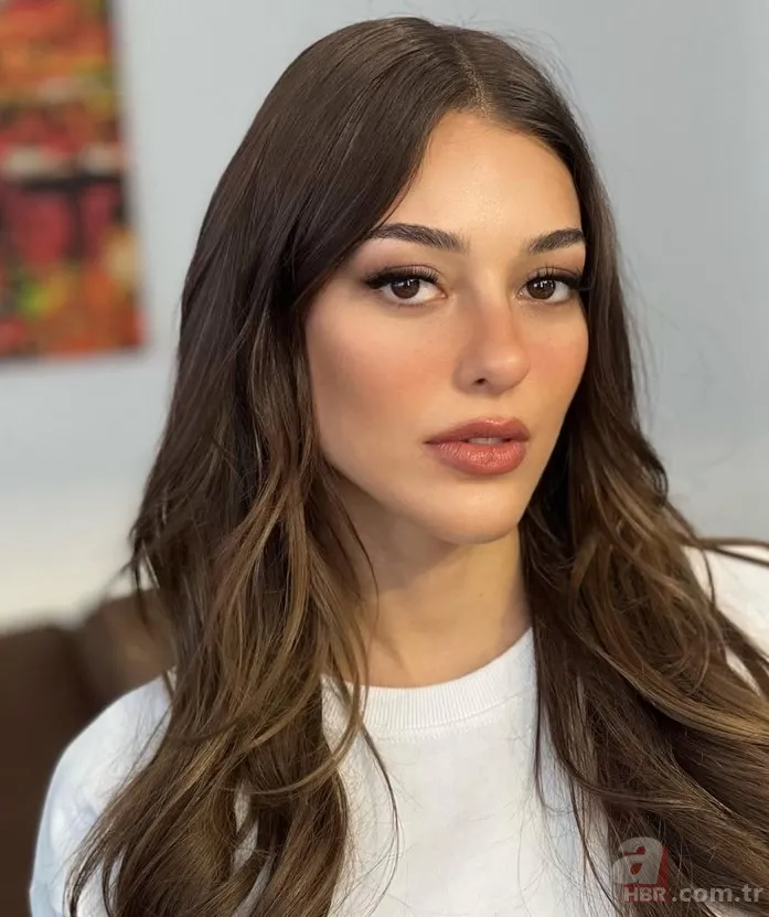 Oyuncu Dilan Çiçek Deniz'e köpek saldırdı! Sağlık durumu... 4