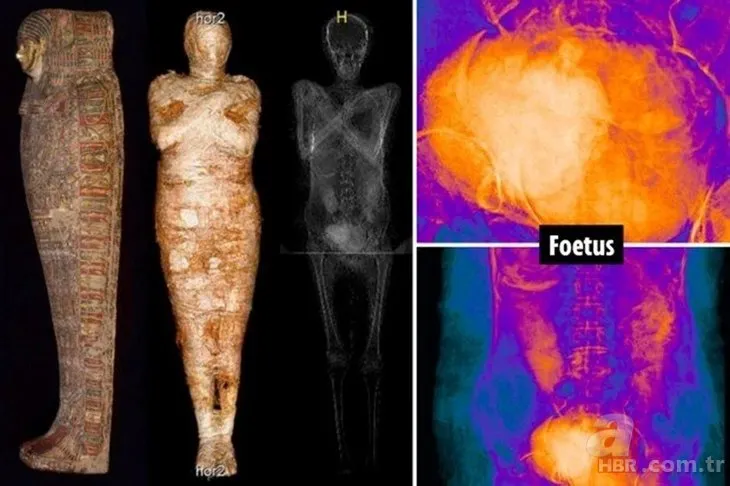 Doğmamış çocuğuyla mumyalandı: 2 bin yıl nasıl bozulmadan kaldı? Gerçek bir insanlık trajedisi