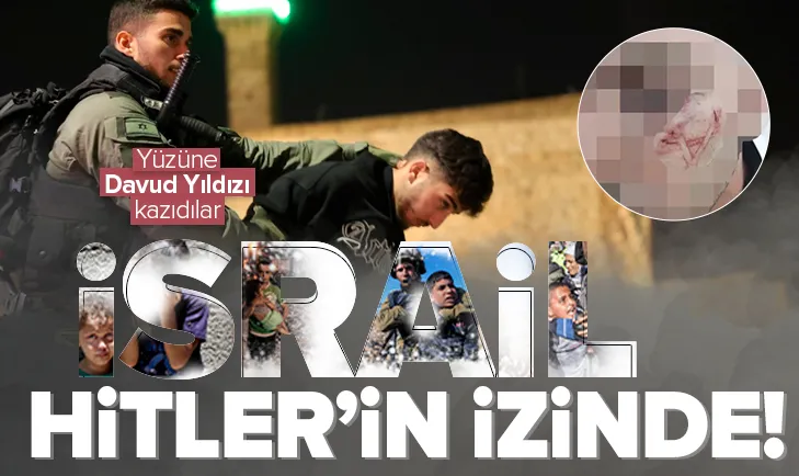 Filistinli gencin yüzüne Davud Yıldızı kazıdılar!