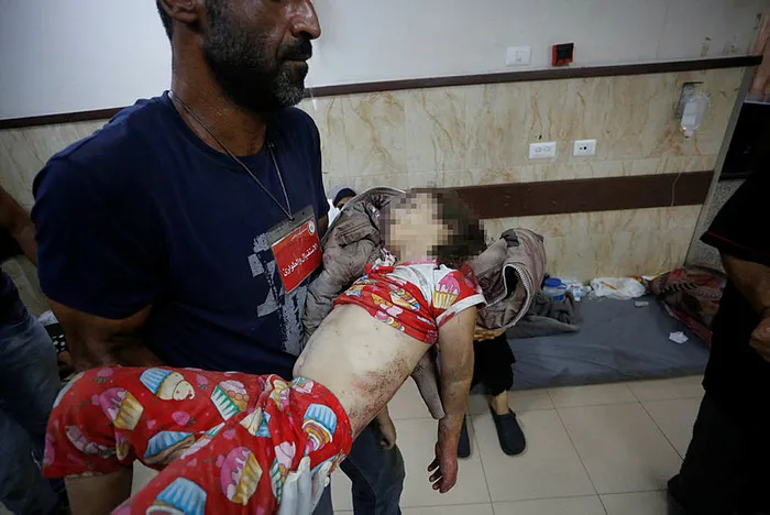 Katil İsrail’den Gazze’ye soykırım saldırısı: Onlarca şehit var | Türkiye’den sert tepki: Bu barbarlığa artık dur denmeli