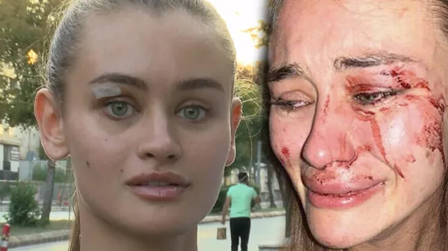 Ukraynalı manken Daria Kyryliuk’un darp olayında flaş gelişme! Sevgilisi Baran Güneş şiddet sabıkalısı çıktı - 6