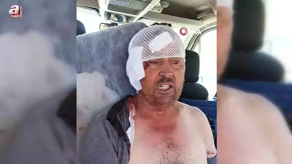 Aslanın saldırısına uğrayan çiftçi o anları anlattı: Biraz güçlü olmasaydım şu anda bende belki de yoktum