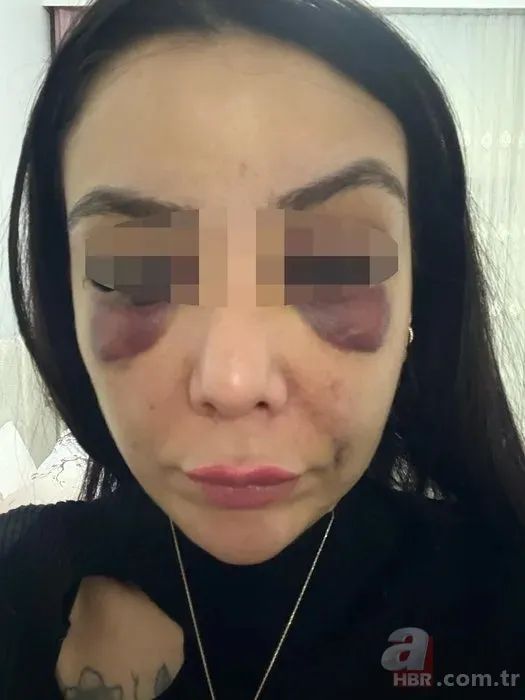 Lisanlı kick boksçudan iş arkadaşına kıskançlık dayağı! 3