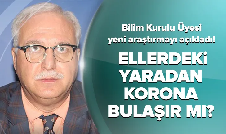 Ellerdeki yaradan korona bulaşır mı? Bilim Kurulu Üyesi açıkladı