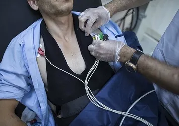Türkiye kalp hastalıklarından kaynaklanan ölümlerde ilk sırada