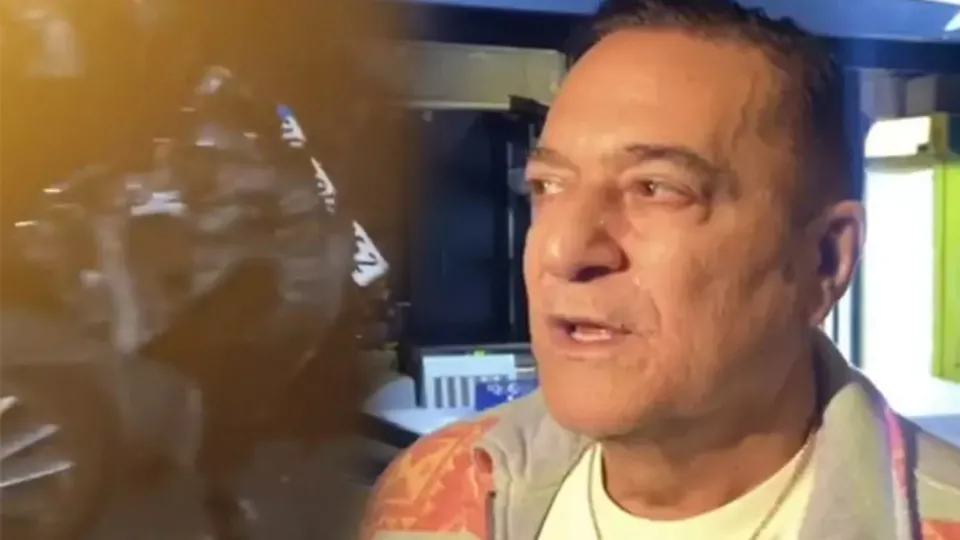 Feci kaza! Mehmet Ali Erbil korkunç kaza sonrası konuştu! "Hala acı çekiyorum"