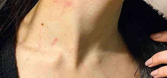 Lüks otelde taciz dehşeti! Sözleri kan dondurdu...