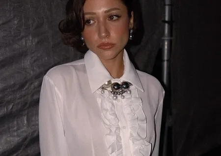 Zeynep Bastık burun ameliyatı oldu! Böyle duyurdu...