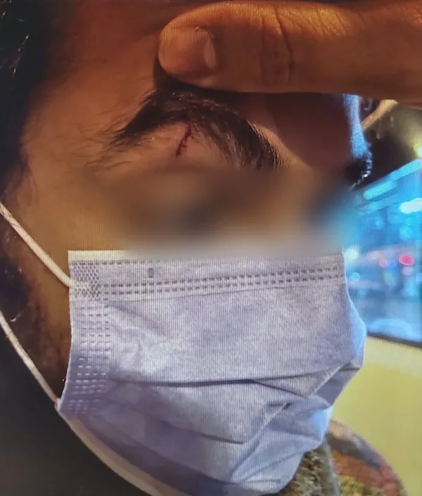 Son dakika: Maganda İETT şoföründen trajikomik savunma: Otobüste doğum günü yaptılar! Yolcular yaralanmıştı - 5