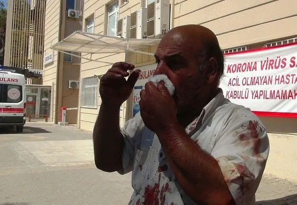 Bir Kurban Bayramı klasiği! Türkiye genelinde 5 bin 282 acemi kasap yaralandı - 4
