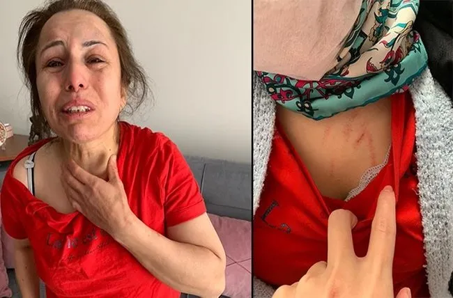 İstanbul eski koca dehşeti! Kaçırdı, dövdü, işkence yaptı ve ölümle tehdit etti - 2