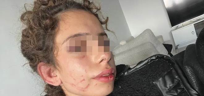 Konya'da korkunç olay! 19 yaşındaki genç kızı öldüresiye dövdü