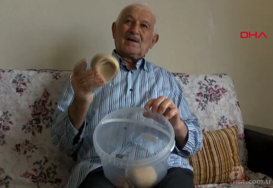 Karın bölgesinde şişlik ve halsizlik şikayetiyle doktora gitti! Karnından çıkanlar şoke etti 23