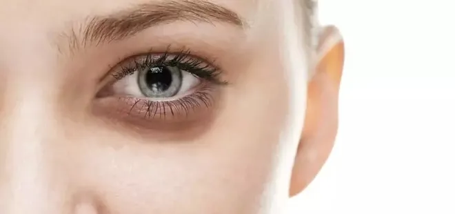 Gözaltı morlukları dert olmaktan çıkacak! 1 ay boyunca...